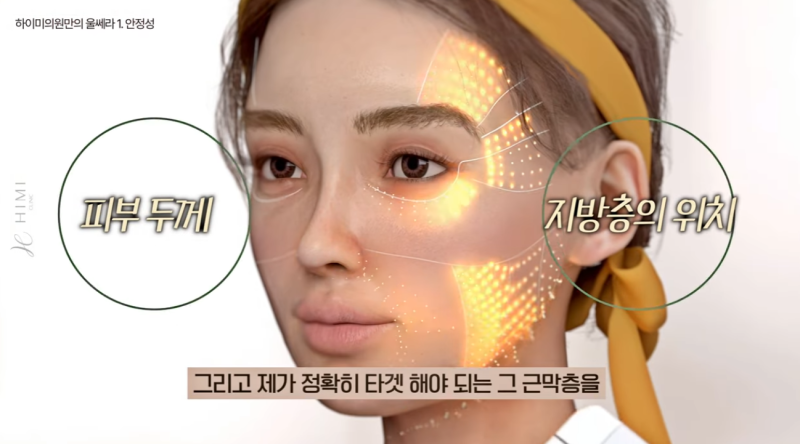 울쎄라 볼패임 걱정된다면? 얼굴살 적은 분들이 꼭 확인해야 할 것 사진 5