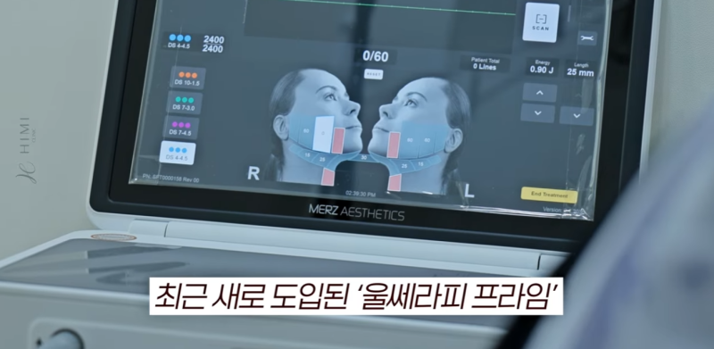 울쎄라 볼패임 걱정된다면? 얼굴살 적은 분들이 꼭 확인해야 할 것 사진 14