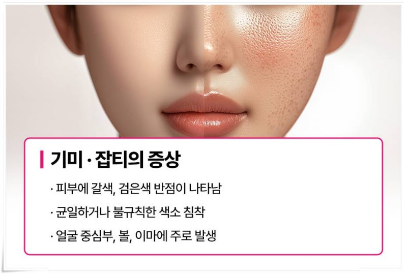 원인을 정확하게 파악하고 연산동 기미 잡티