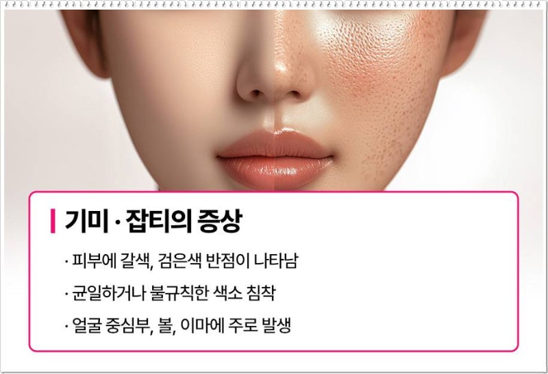연산역잡티 손으로 짜면 안되는