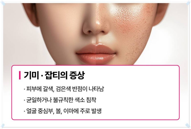 연산동기미 자외선 차단제 필수입니다