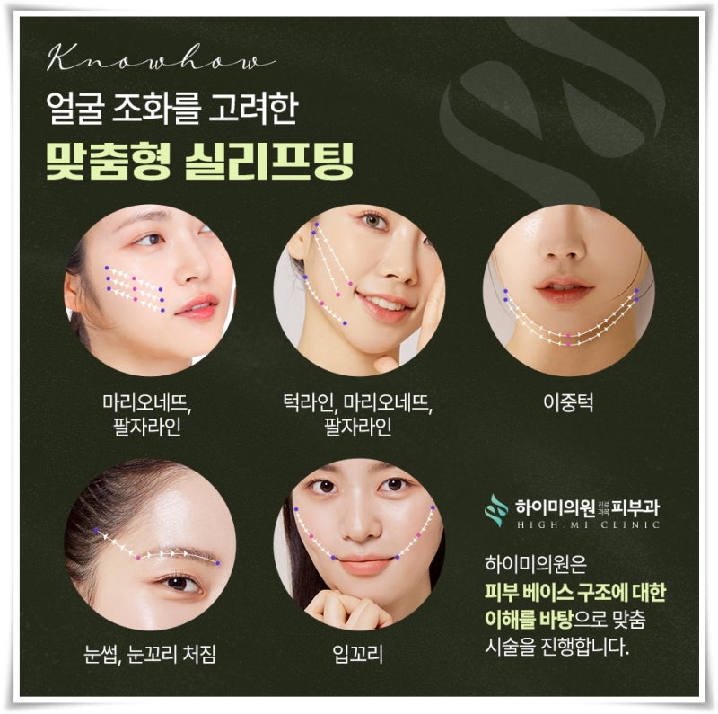 하이미의원 실리프팅 다양한 부위에 시술을