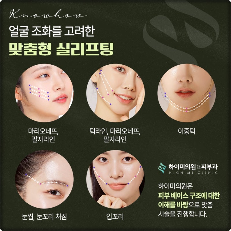 연산역실리프팅 오랜 기간 지속되는 효과
